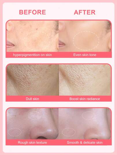 Sérum Rose Éclatant SlowSunday, Hydratation Profonde, Éclaircit la Peau, Uniformise le Teint, Améliore la Teint Terne, Parfait comme Base Hydratante, Base Lissante et Floutante Minimisant les Pores, Convient pour l'Été & l'Automne, Y2K, Idéal pour les Fêt