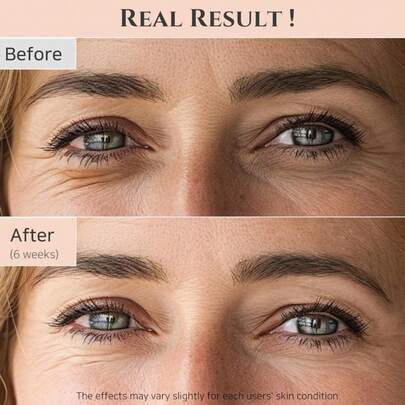 Beauty of Joseon - Revitalizing Eye Contour Serum - Soin contour des yeux