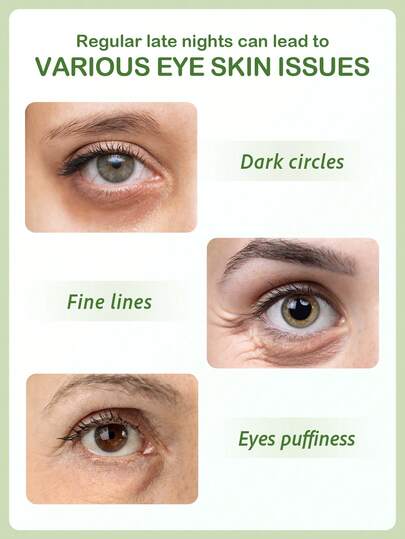 Masque apaisant pour les yeux SlowSunday à l'aloe vera, 60 pièces, patchs pour les yeux, soins de la peau coréens, extrait d'aloe vera & hyaluronate de sodium, réduit les poches sous les yeux, améliore les cernes, illumine le contour des yeux, convient po
