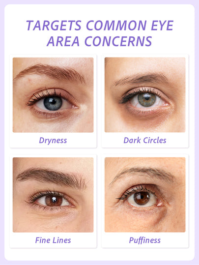 Sérum pour les yeux Slow Sunday Retinal Tightening, hydratant et éclaircissant, convient pour les cernes, les ridules et les poches sous les yeux, bon choix pour les vacances, les essentiels de voyage, Halloween, convient pour les soins des yeux en été
