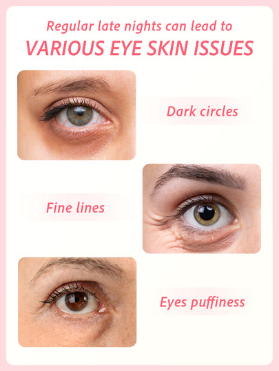 Masque pour les yeux SlowSunday Rose, 60 pièces, masque pour les yeux au collagène coréen, avec extrait de rose & collagène & hyaluronate de sodium, atténue les poches sous les yeux, améliore les cernes, illumine le contour des yeux, Y2K, cadeaux, convien