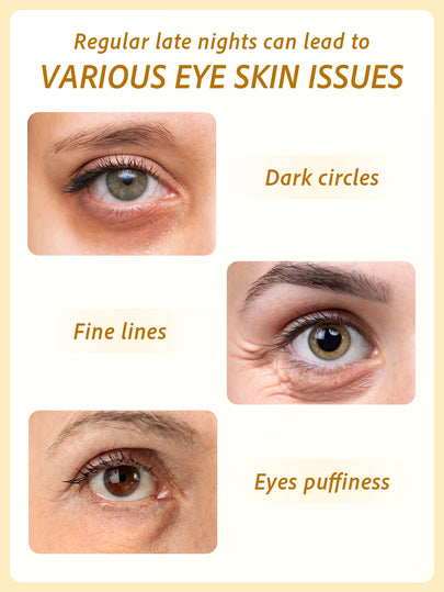 SlowSunday Patchs pour les yeux en or 24K, 60 pièces, Masque pour les yeux au collagène coréen, Patchs sous les yeux, Avec or 24K & collagène & hyaluronate de sodium, Diminue les poches sous les yeux, Améliore les cernes, Pour les yeux gonflés, Y2K, Idéal