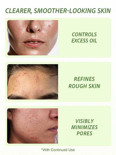 Sérum SlowSunday Blemish Tea Tree, avec Niacinamide, Huile de Tea Tree & Acide Salicylique, Contrôle du Sébum, Unifie le Teint du Visage, Convient pour l'Été & l'Automne, Y2K, Pour Fêtes & Cadeaux, Idéal pour Fêtes, Halloween